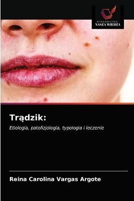 Tr?dzik By Vargas Argote 9786203482584 (Paperback)