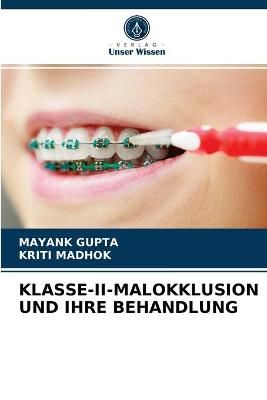 Klasse-II-Malokklusion Und Ihre Behandlung By Mayank Gupta (Paperback)