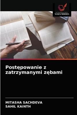 Post?powanie z zatrzymanymi z?bami By Sachdeva 9786203603354