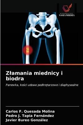Zlamania miednicy i biodra By Quesada Molina 9786203641127 (Paperback)