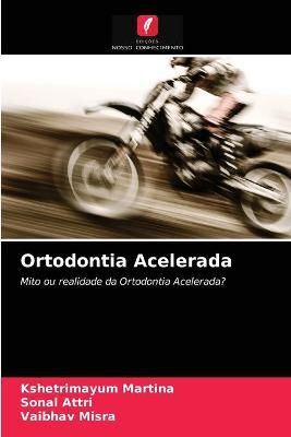 Ortodontia Acelerada By Martina 9786203644982 (Paperback)