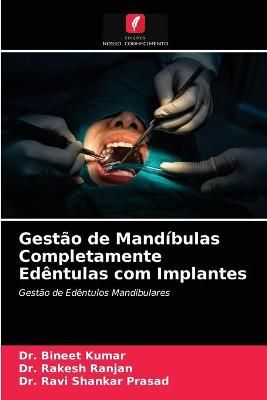 Gestão de Mandíbulas Completamente Edêntulas com Implantes By Kumar