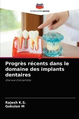 Progrès récents dans le domaine des implants dentaires By K S