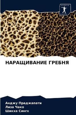 ??????????? ?????? By ?????????? 9786204076034 (Paperback)