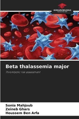 Beta thalassemia major By Mahjoub 9786204125725 (Paperback)