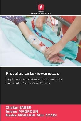 Fístulas arteriovenosas By Jaber 9786205285152 (Paperback)