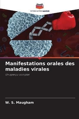 Manifestations orales des maladies virales By Maugham 9786205298398