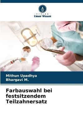Farbauswahl bei festsitzendem Teilzahnersatz By Upadhya 9786205303641