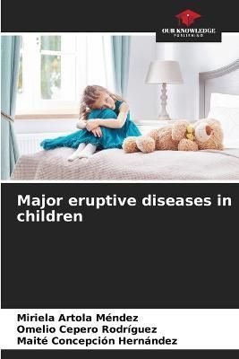 Major Eruptive Diseases in Children 9786205331743 (Paperback)