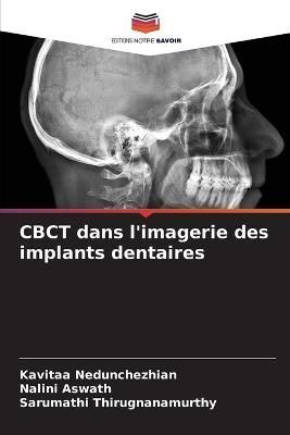 CBCT dans l'imagerie des implants dentaires By Nedunchezhian