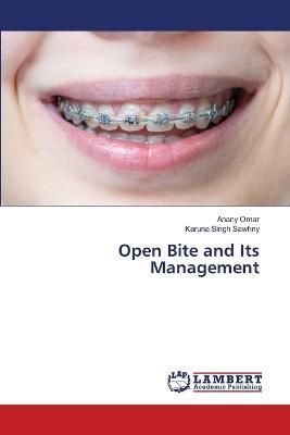 Open Bite and Its Management By Omar 9786205497982 (Paperback)