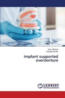 implant supported overdenture By Singla 9786205502396 (Paperback)