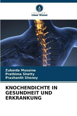 Knochendichte in Gesundheit Und Erkrankung By Musaina 9786205600290