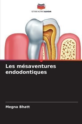 Les mésaventures endodontiques By Bhatt 9786205613023 (Paperback)