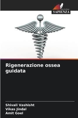 Rigenerazione ossea guidata By Vashisht 9786205619537 (Paperback)