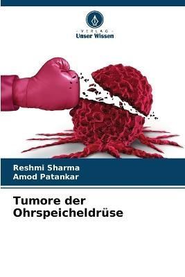 Tumore der Ohrspeicheldrüse By Sharma 9786205671566 (Paperback)