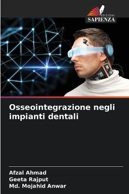 Osseointegrazione negli impianti dentali By Ahmad 9786205678275