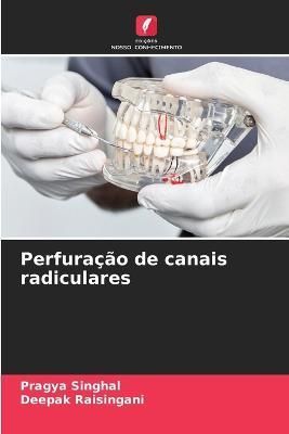 Perfuração de canais radiculares By Singhal 9786205688724