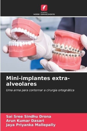 Mini-implantes extra-alveolares By Drona 9786205978184 (Paperback)