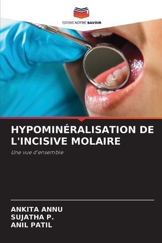 Hypominéralisation de l'Incisive Molaire By Annu 9786205982396