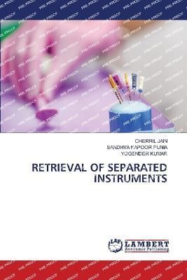 Retrieval of Separated Instruments By Jain 9786206151159 (Paperback)