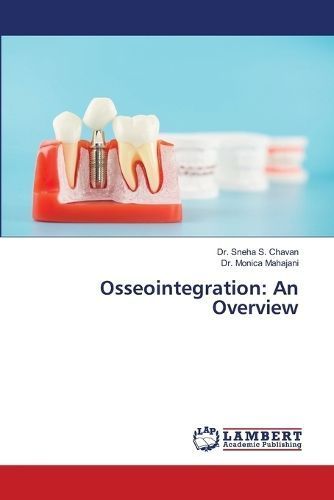 Osseointegration By Chavan 9786206156390 (Paperback)