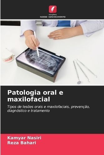 Patologia oral e maxilofacial By Nasiri 9786206211754 (Paperback)