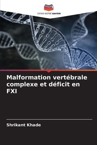 Malformation Vertébrale Complexe Et Déficit En FXI By Shrikant Khade