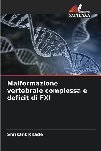Malformazione Vertebrale Complessa E Deficit Di FXI By Shrikant Khade