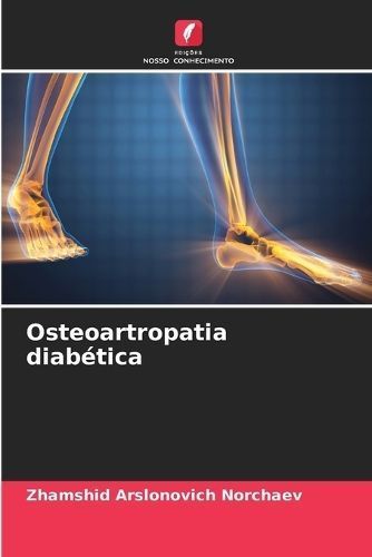 Osteoartropatia Diabética By Zhamshid Arslonovich Norchaev