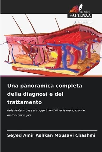 Una Panoramica Completa Della Diagnosi E Del Trattamento 9786206564126