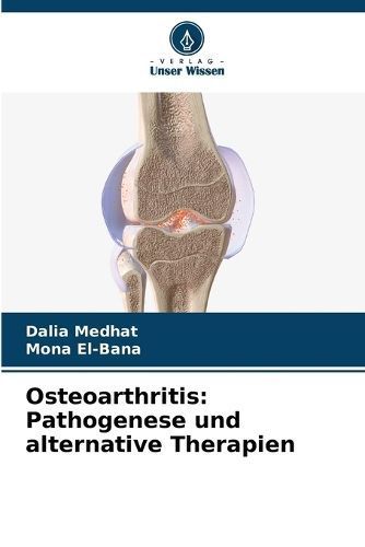 Osteoarthritis By Dalia Medhat, Mona El-Bana 9786206950370 (Paperback)