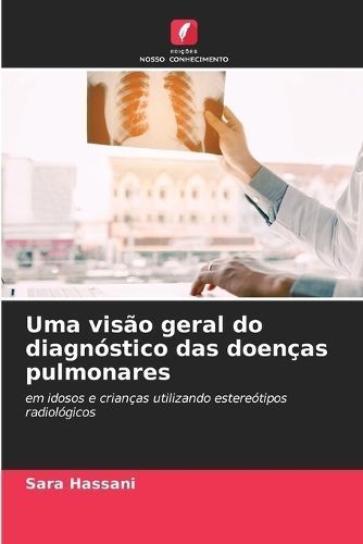 Uma Visão Geral Do Diagnóstico Das Doenças Pulmonares 9786206971382