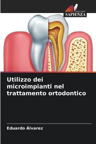 Utilizzo dei microimpianti nel trattamento ortodontico By ?lvarez