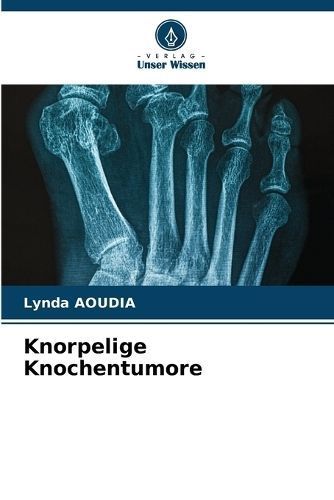 Knorpelige Knochentumore By Aoudia 9786207064540 (Paperback)