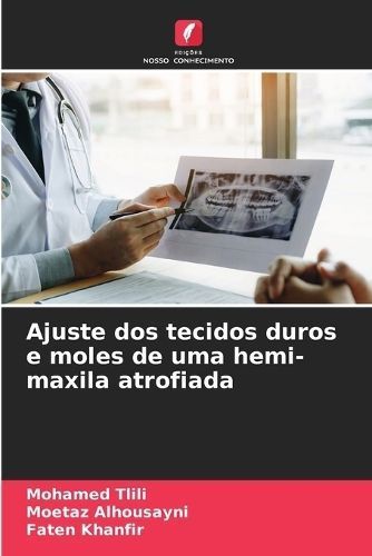 Ajuste dos tecidos duros e moles de uma hemi-maxila atrofiada By Tlili