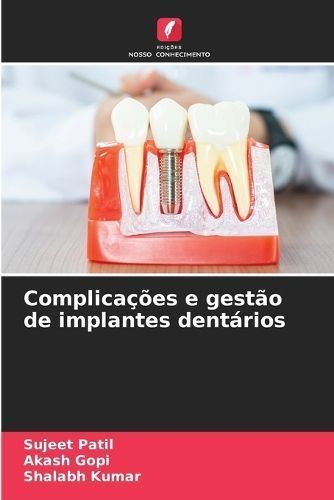 Complica??es e gest?o de implantes dent?rios By Patil 9786207225569