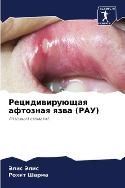 Recidiwiruüschaq aftoznaq qzwa (RAU) By Jelis, Jelis 9786207419050