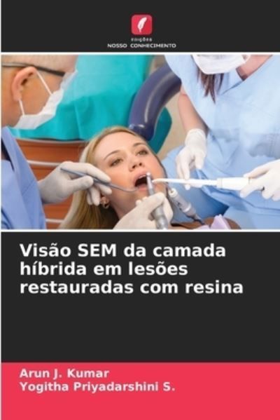 Vis?o SEM da camada h?brida em les?es restauradas com resina