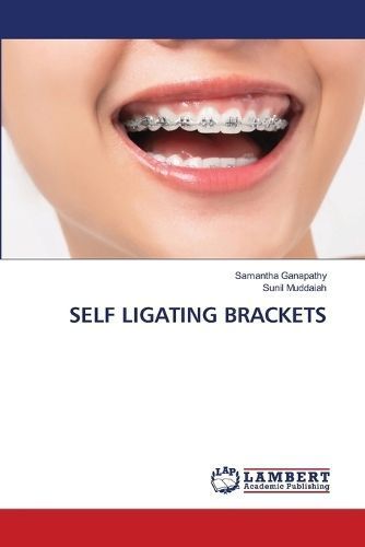 Self Ligating Brackets By Samantha Ganapathy, Sunil Muddaiah