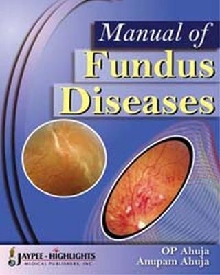 Manual of Fundus Diseases By OP Ahuja 9788184489644 (Hardback)