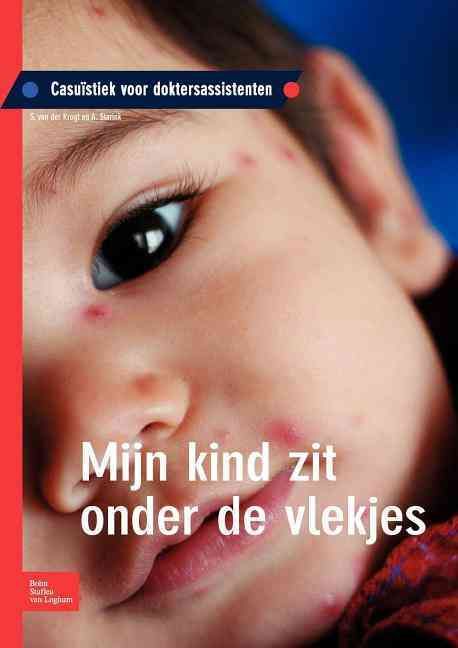 Mijn kind zit onder de vlekjes By Krogt, S. 9789031378982 (Paperback)