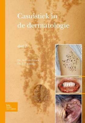 Casuïstiek in de dermatologie By Toonstra, Johan 9789031384570