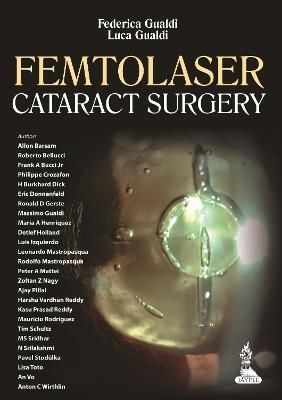 Femtolaser Cataract Surgery By Federica Gualdi, Luca Gualdi (Hardback)