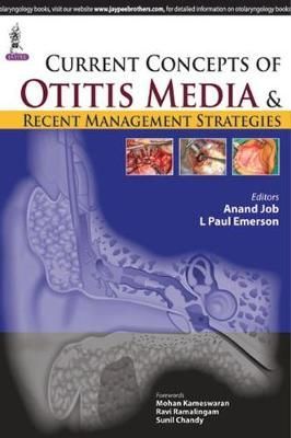 Current Concepts of Otitis Media and Recent Management Strategies