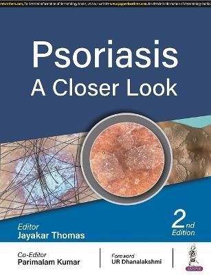 Psoriasis By Jayakar Thomas, Parimalam Kumar 9789354659805 (Paperback)