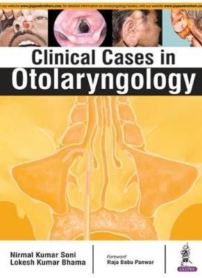 Clinical Cases in Otolaryngology By Kumar Nirmal Soni 9789385891618