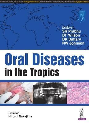 Oral Diseases in the Tropics By S R Prabhu 9789386150554 (Paperback)