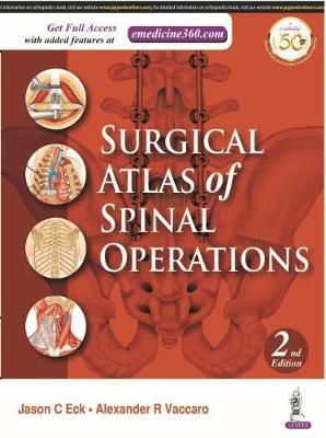 Surgical Atlas of Spinal Operations By Vaccaro, Alexander R (Hardback)
