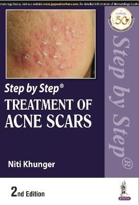 Step by Step Treatment of Acne Scars By Niti Khunger 9789389188363